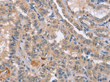CD36 Polyclonal Antibody Store at -20°C Host Rabbit