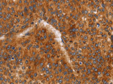 CD38 Polyclonal Antibody Store at -20°C