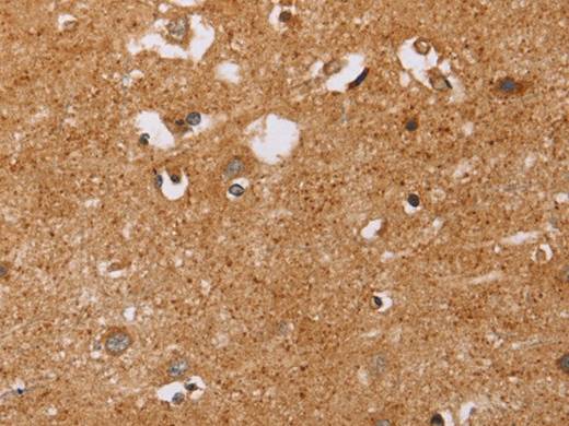 CD38 Polyclonal Antibody Store at -20°C