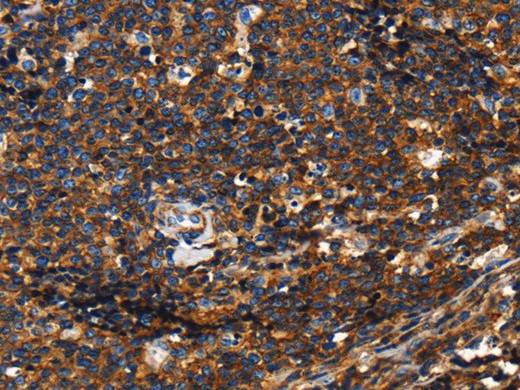 CD45 Polyclonal Antibody Store at -20°C Host Rabbit