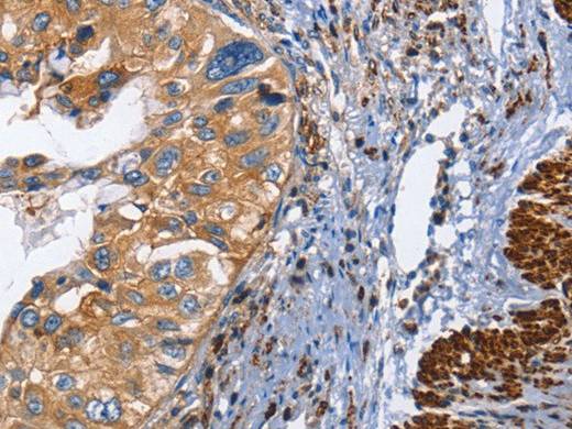 CD45 Polyclonal Antibody Store at -20°C Host Rabbit