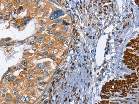 CD45 Polyclonal Antibody Store at -20°C Host Rabbit