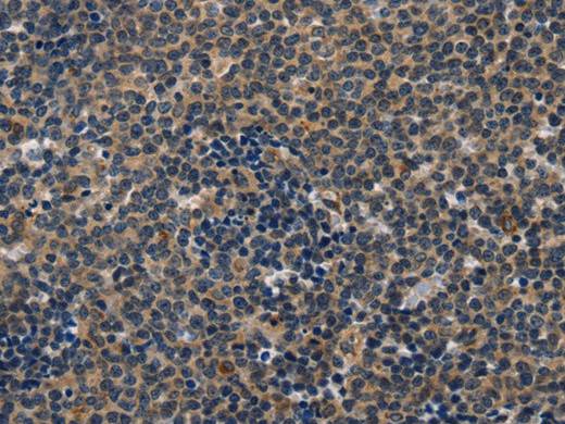 CD47 Polyclonal Antibody Store at -20°C