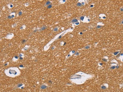 CD47 Polyclonal Antibody Store at -20°C