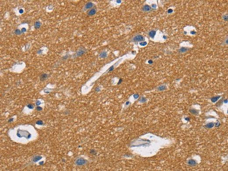 CD47 Polyclonal Antibody Store at -20°C