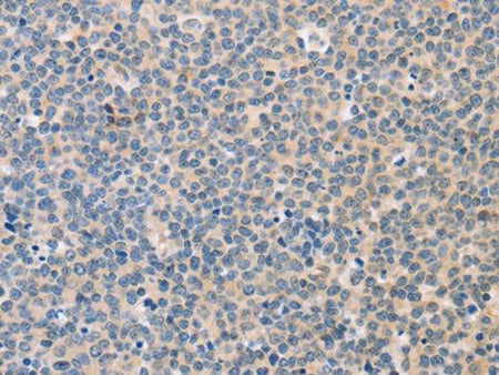 CD56 Polyclonal Antibody