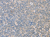 CD56 Polyclonal Antibody