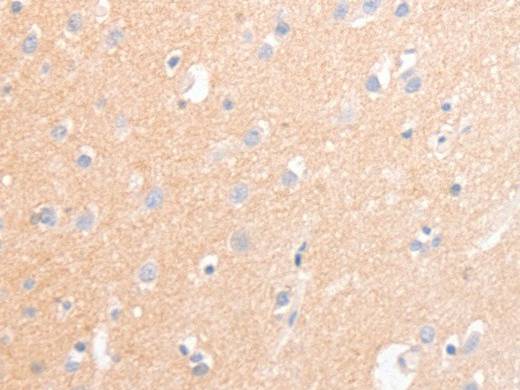 CD56 Polyclonal Antibody