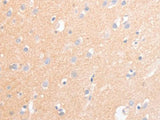 CD56 Polyclonal Antibody