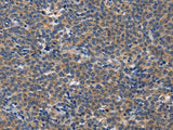 CD5L Polyclonal Antibody
