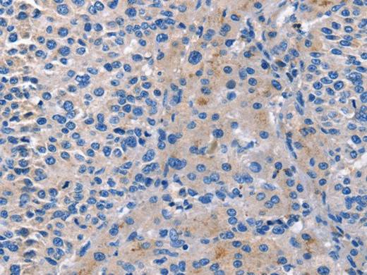 CD5L Polyclonal Antibody