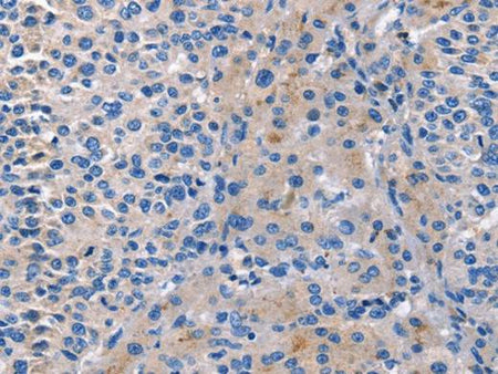 CD5L Polyclonal Antibody