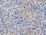 CD5L Polyclonal Antibody