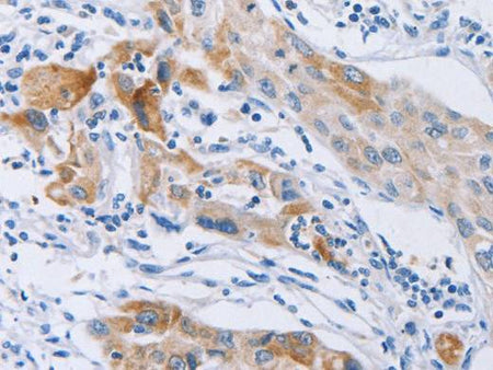 CDC27 Polyclonal Antibody Store at -20°C Host Rabbit