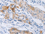 CDC27 Polyclonal Antibody Store at -20°C Host Rabbit