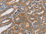 CDK11A/B Polyclonal Antibody