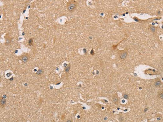 CDK11A/B Polyclonal Antibody