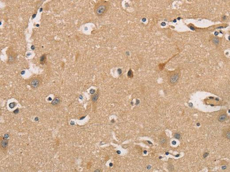 CDK11A/B Polyclonal Antibody