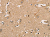 CDK11A/B Polyclonal Antibody