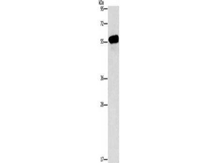 CDK19 Polyclonal Antibody Store at -20°C Host Rabbit