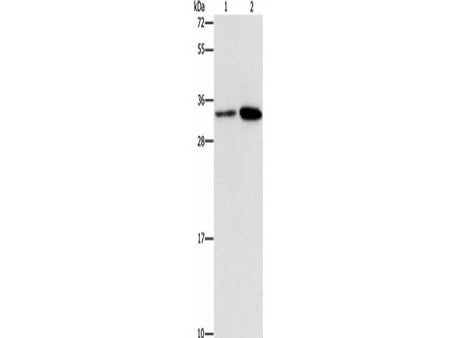 CDC34 Polyclonal Antibody Store at -20°C Host Rabbit