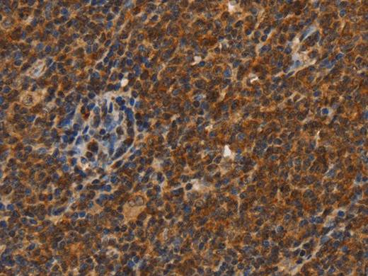 CDC34 Polyclonal Antibody Store at -20°C Host Rabbit