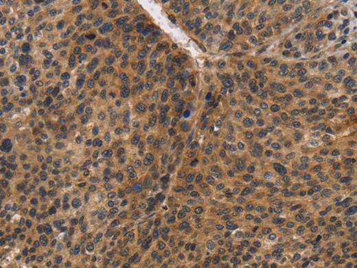 CDC34 Polyclonal Antibody Store at -20°C Host Rabbit