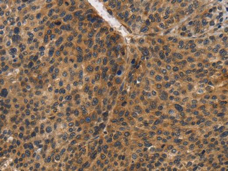 CDC34 Polyclonal Antibody Store at -20°C Host Rabbit