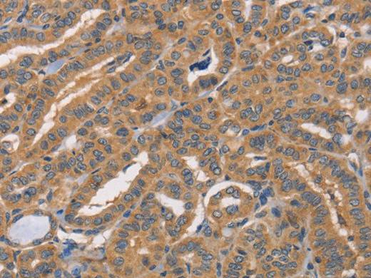 CDCA4 Polyclonal Antibody Store at -20°C Host Rabbit