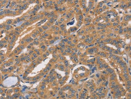 CDCA4 Polyclonal Antibody Store at -20°C Host Rabbit