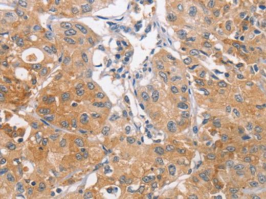 CDCA4 Polyclonal Antibody Store at -20°C Host Rabbit