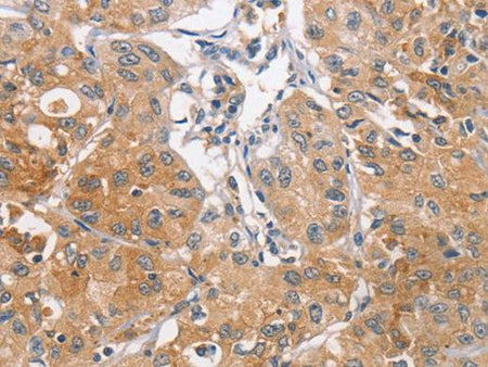CDCA4 Polyclonal Antibody Store at -20°C Host Rabbit