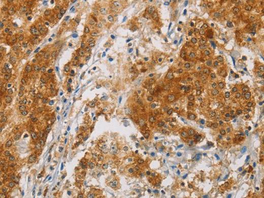 CENPE Polyclonal Antibody Store at -20°C Host Rabbit