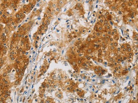 CENPE Polyclonal Antibody Store at -20°C Host Rabbit