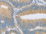 CENPE Polyclonal Antibody Store at -20°C Host Rabbit