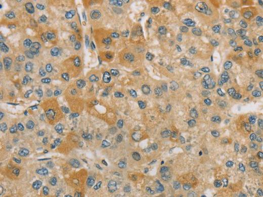 CENPF Polyclonal Antibody Store at -20°C Host Rabbit