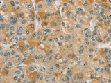 CENPF Polyclonal Antibody Store at -20°C Host Rabbit
