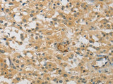 CENPF Polyclonal Antibody Store at -20°C Host Rabbit