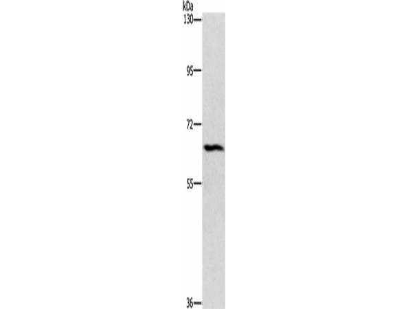 CERKL Polyclonal Antibody Store at -20°C Host Rabbit