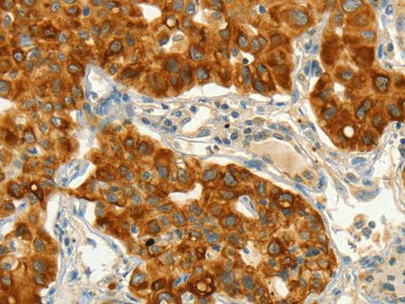 CIB1 Polyclonal Antibody Store at -20°C Host Rabbit