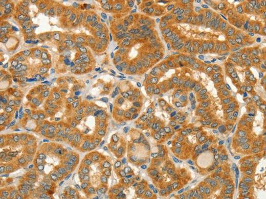 CIB1 Polyclonal Antibody Store at -20°C Host Rabbit