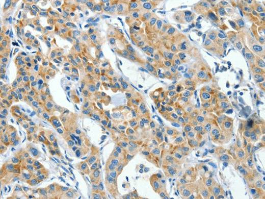 CKAP4 Polyclonal Antibody Store at -20°C Host Rabbit