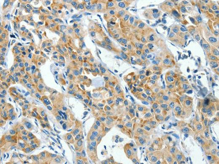 CKAP4 Polyclonal Antibody Store at -20°C Host Rabbit