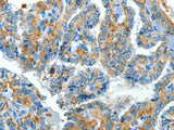 CLPTM1L Polyclonal Antibody