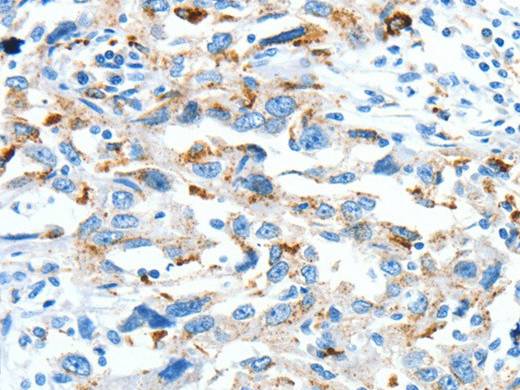 CLPTM1L Polyclonal Antibody