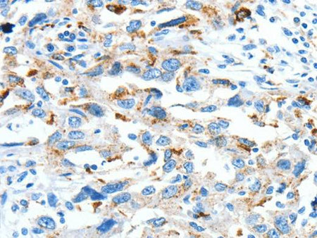 CLPTM1L Polyclonal Antibody