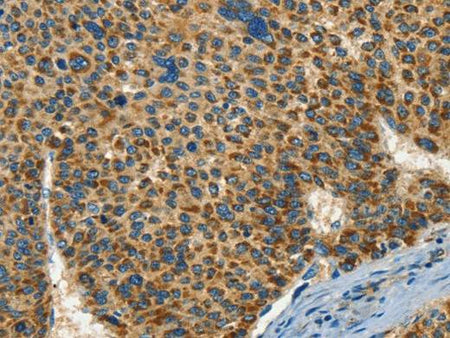 IFT74 Polyclonal Antibody Store at -20°C Host Rabbit