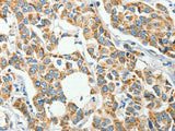 IFT74 Polyclonal Antibody Store at -20°C Host Rabbit