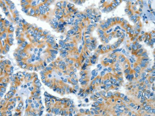COG1 Polyclonal Antibody