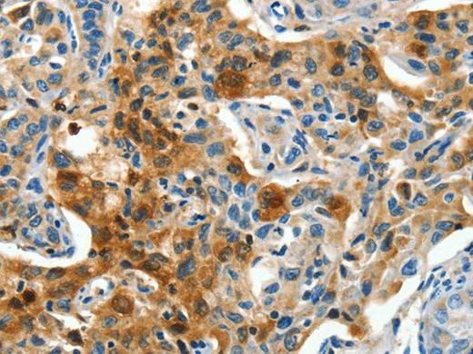 COG1 Polyclonal Antibody